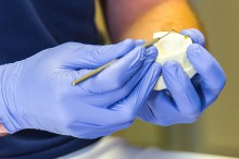 Zahnersatz mit Implantate